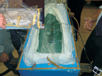 vakuový ( bag) pytel při laminování infuzí od sika axson