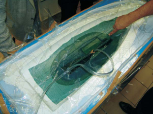 INFUZE A PROSYCENÍ PRYSKYŘICÍ SIKA AXSON